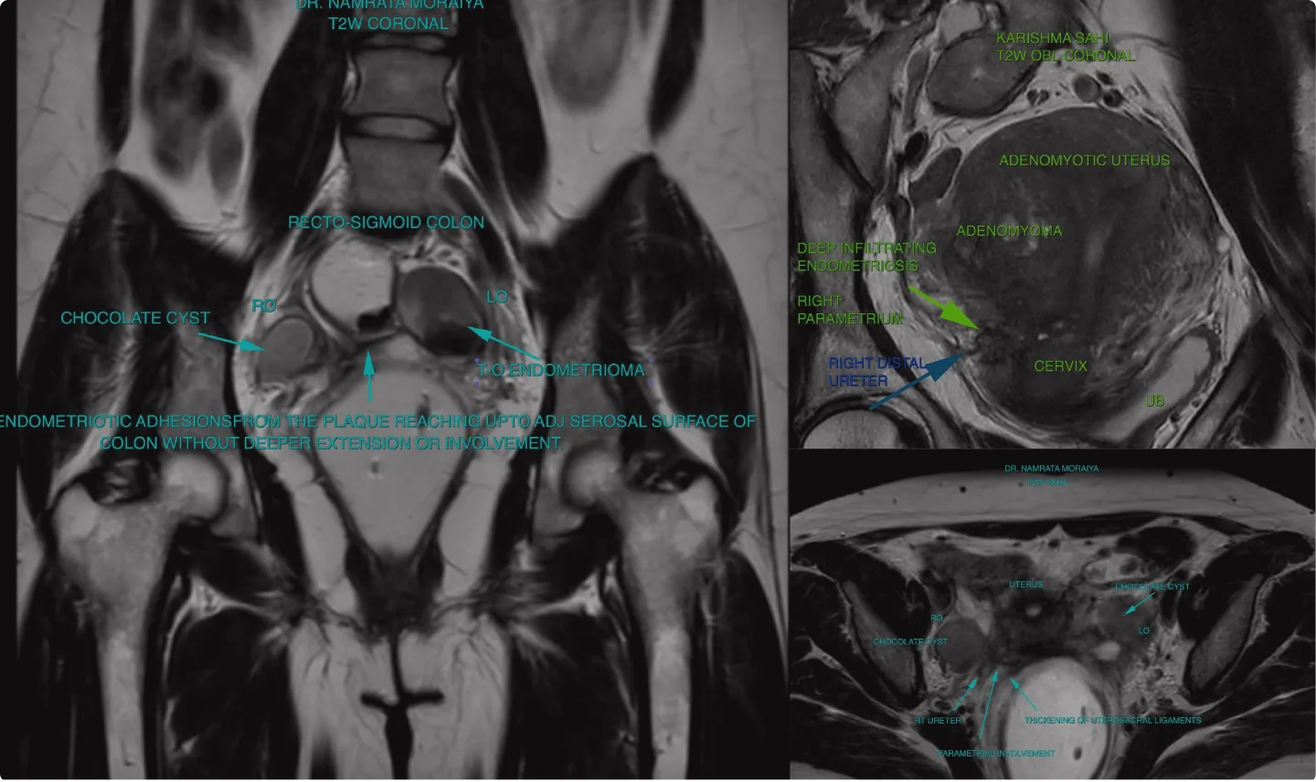 MRI banner image