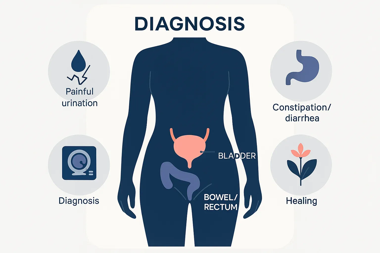 Infographic of a female pelvic silhouette highlighting bladder and bowel, with icons showing painful urination, bowel issues, diagnosis, and healing for endometriosis.