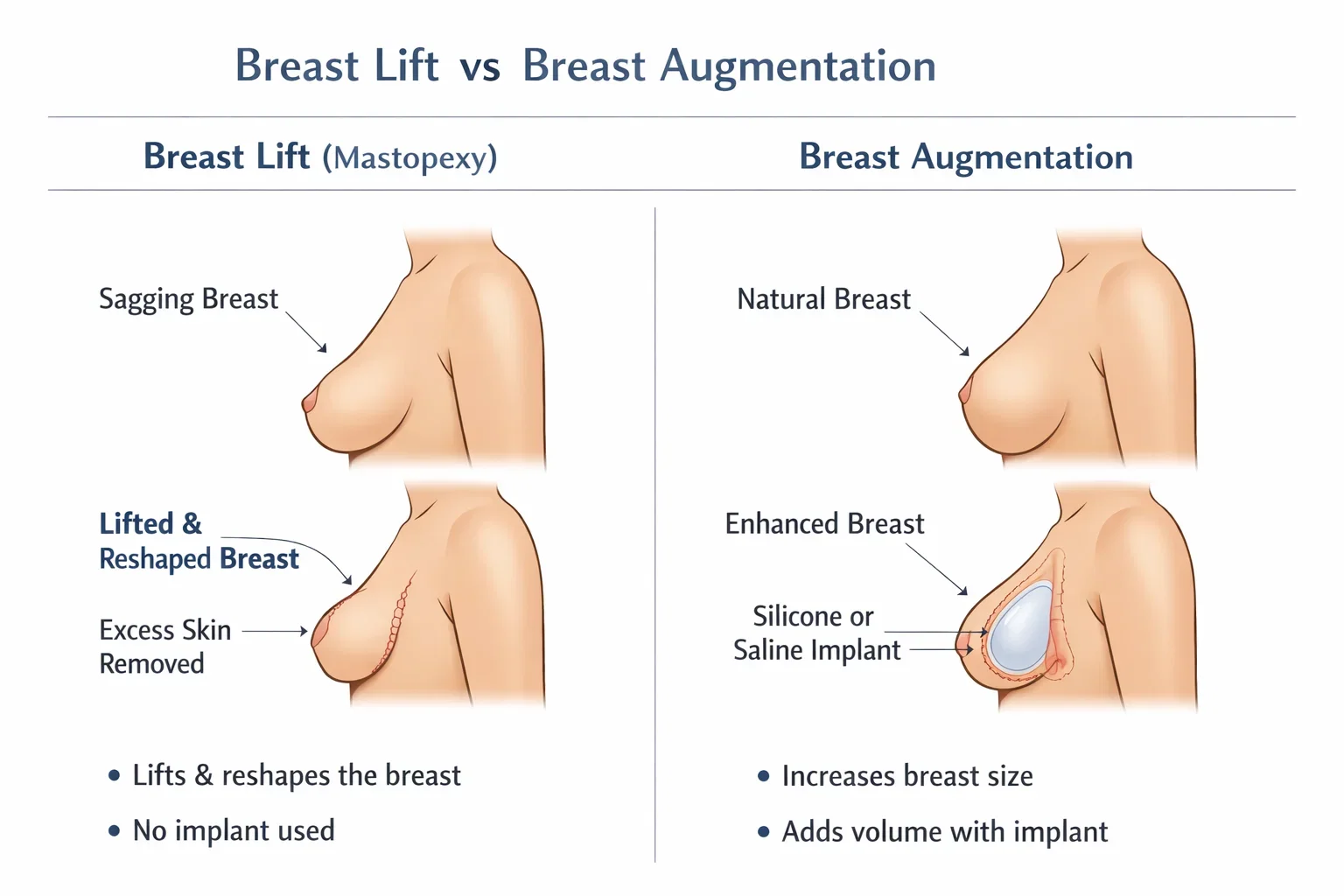 Infographic explaining breast lift vs breast augmentation differences.