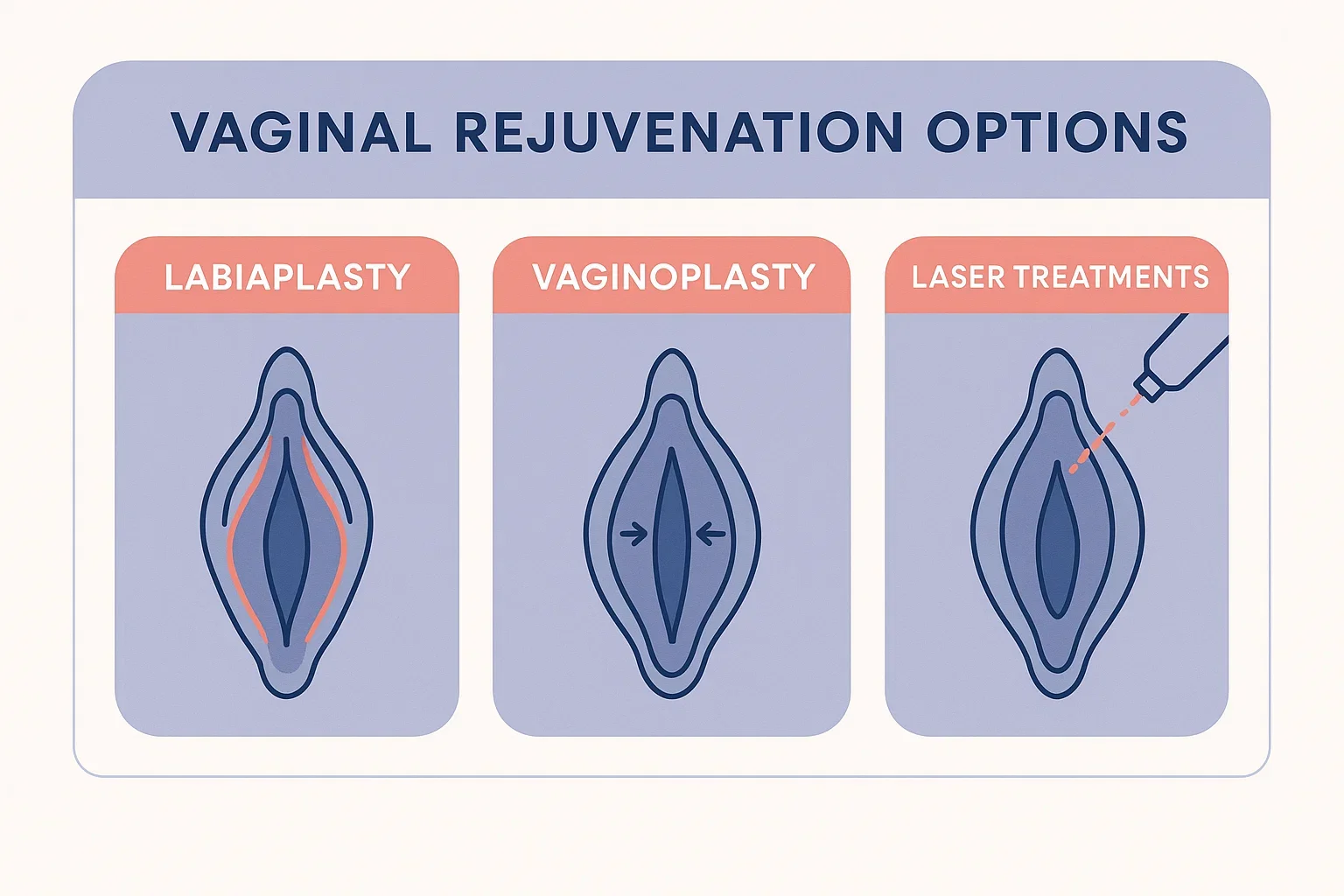 Infographic explaining vaginal rejuvenation procedures including labiaplasty and vaginoplasty.