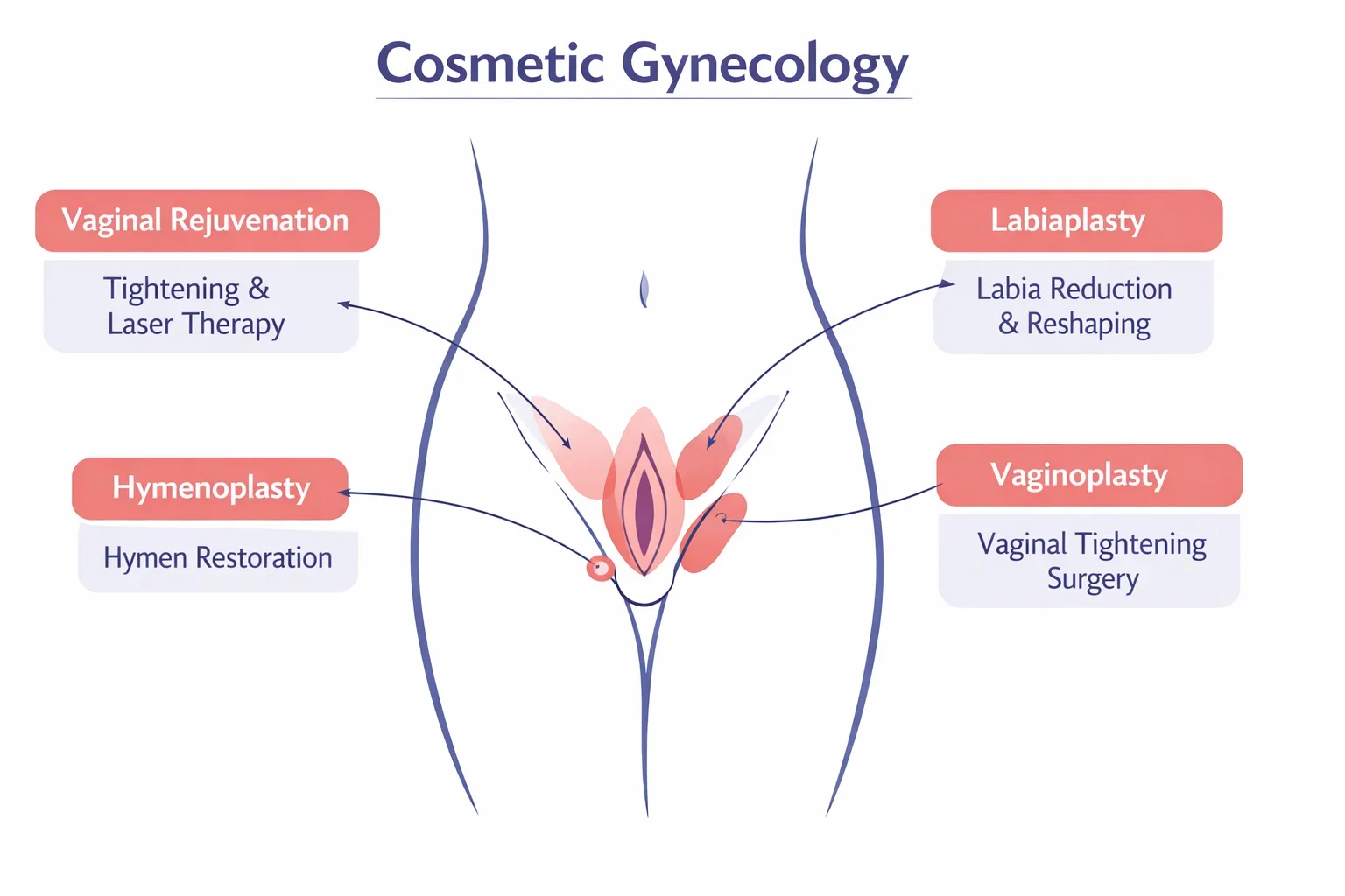 Infographic illustrating cosmetic gynecology procedures and treatment areas.