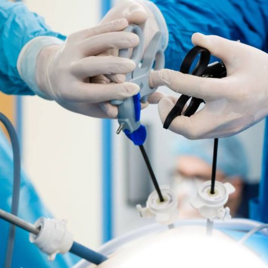 Minimally_Invasive_Robotic_Techniques